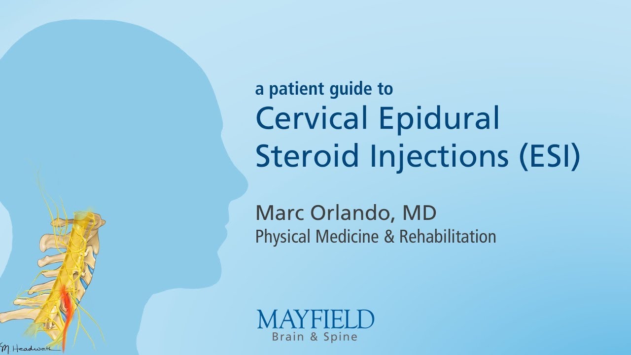 lumbar epidural steroid injection reviews